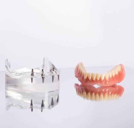 Sample implants posts in clear base on reflective surface next to dentures